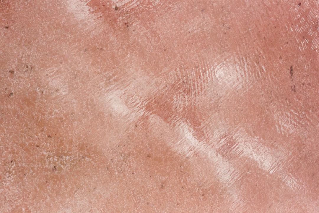 découvrez les causes, symptômes et traitements de l'eczéma. apprenez à gérer cette affection cutanée pour retrouver une peau saine et apaisée.