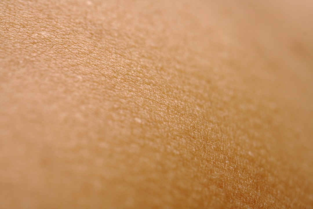 découvrez tout sur l'eczéma : causes, symptômes, traitements et conseils pour soulager cette affection cutanée. informez-vous pour mieux vivre avec l'eczéma.
