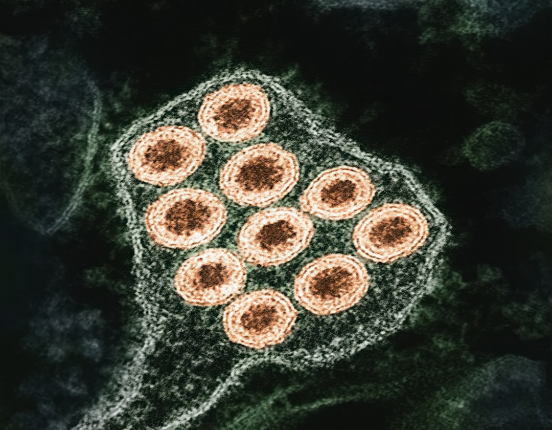 découvrez les meilleurs boosters immunitaires pour renforcer vos défenses naturelles. apprenez comment stimuler votre système immunitaire grâce à des conseils nutritionnels, des suppléments efficaces et des habitudes saines. protégez votre santé avec des solutions simples et naturelles.