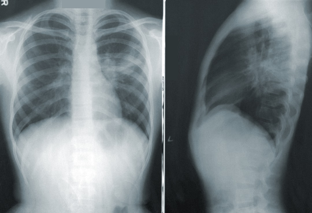 découvrez les bienfaits de l'inhalation pour soulager les voies respiratoires. apprenez à utiliser des méthodes simples et efficaces pour faciliter la respiration et améliorer votre bien-être respiratoire.