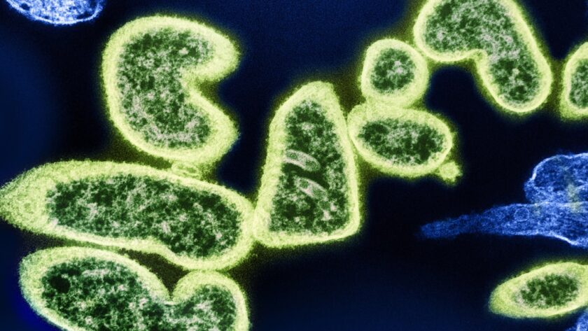 découvrez les bienfaits des antibactériens naturels pour protéger votre santé et votre environnement. optez pour des solutions efficaces et écologiques qui combattent les bactéries tout en respectant votre corps et la planète.