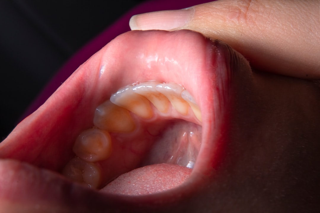 découvrez les meilleurs remèdes contre le mal de gorge pour apaiser votre douleur et retrouver votre confort rapidement. que ce soit des solutions naturelles, des gargarismes ou des conseils pratiques, nous vous guidons vers un soulagement efficace.