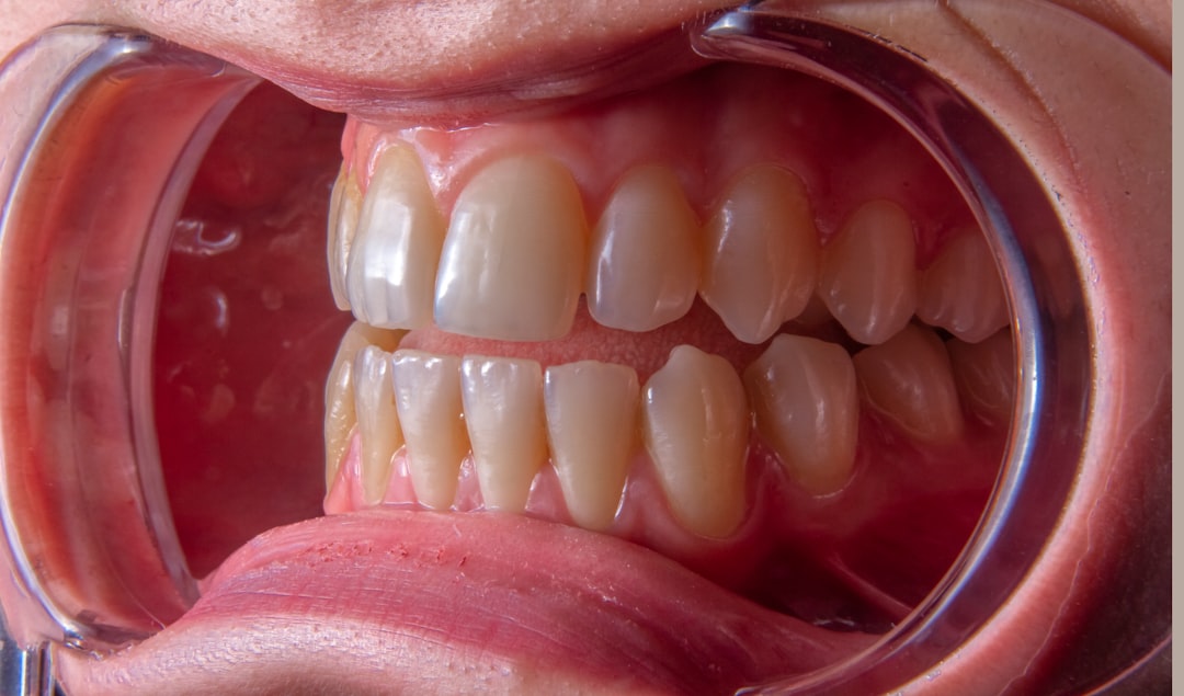 découvrez les causes, symptômes et traitements de la douleur dentaire. apprenez comment soulager vos maux de dents et prendre soin de votre santé bucco-dentaire grâce à nos conseils et recommandations pratiques.