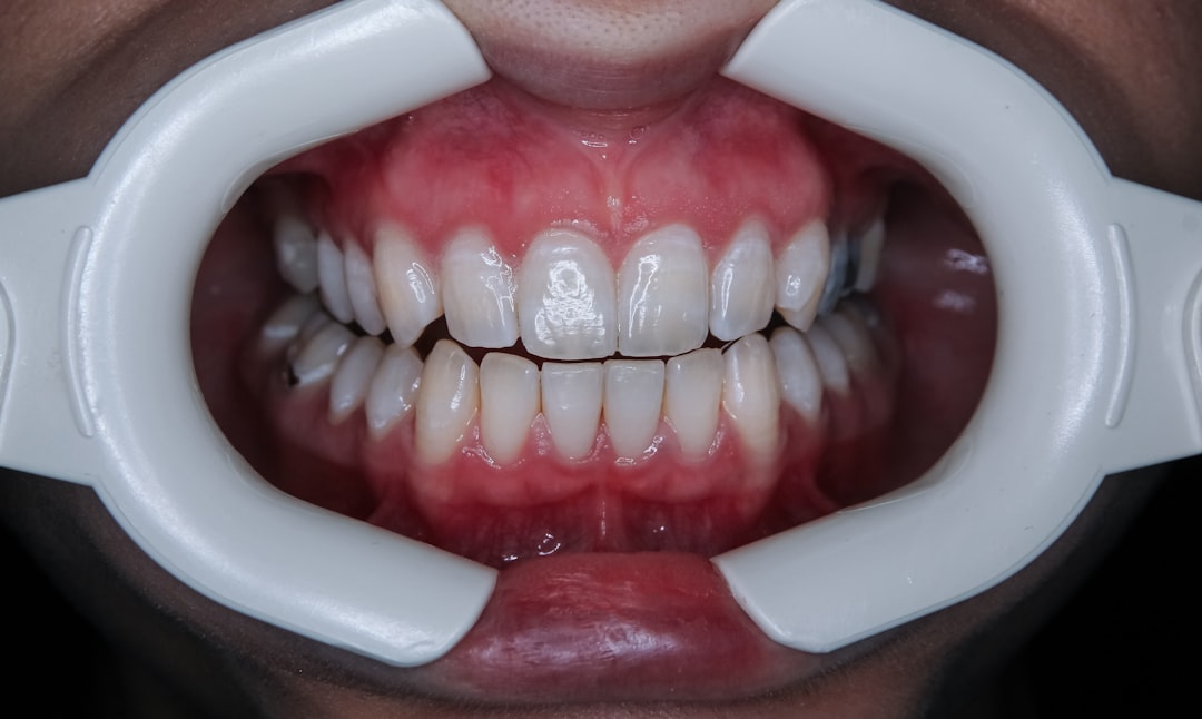 découvrez comment soulager efficacement vos douleurs dentaires avec des conseils pratiques et des remèdes naturels. apprenez à identifier les causes de votre mal de dents et quand consulter un professionnel pour un traitement approprié.